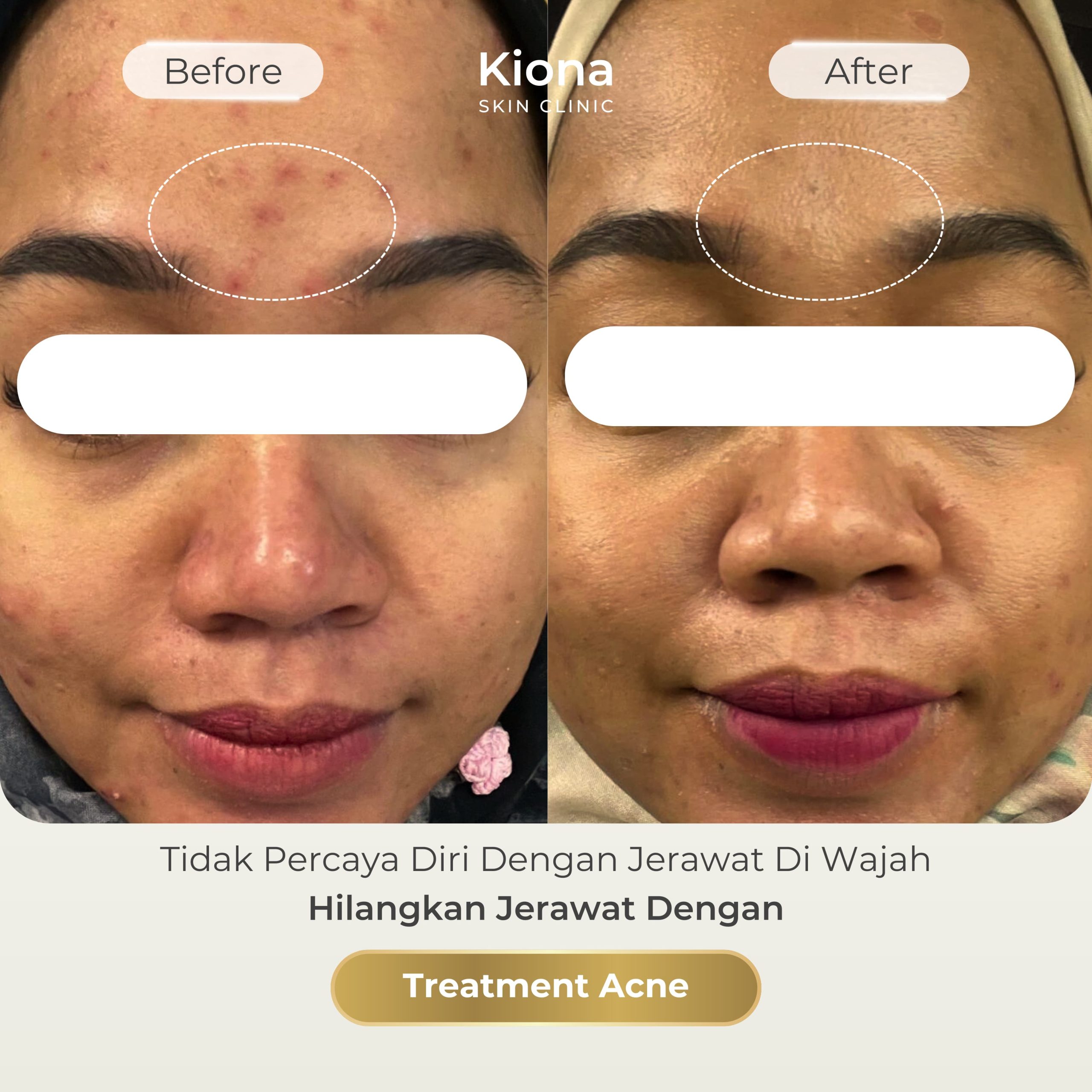 8fd6aa21-b1e8-4df6-8844-be26ccfffef9