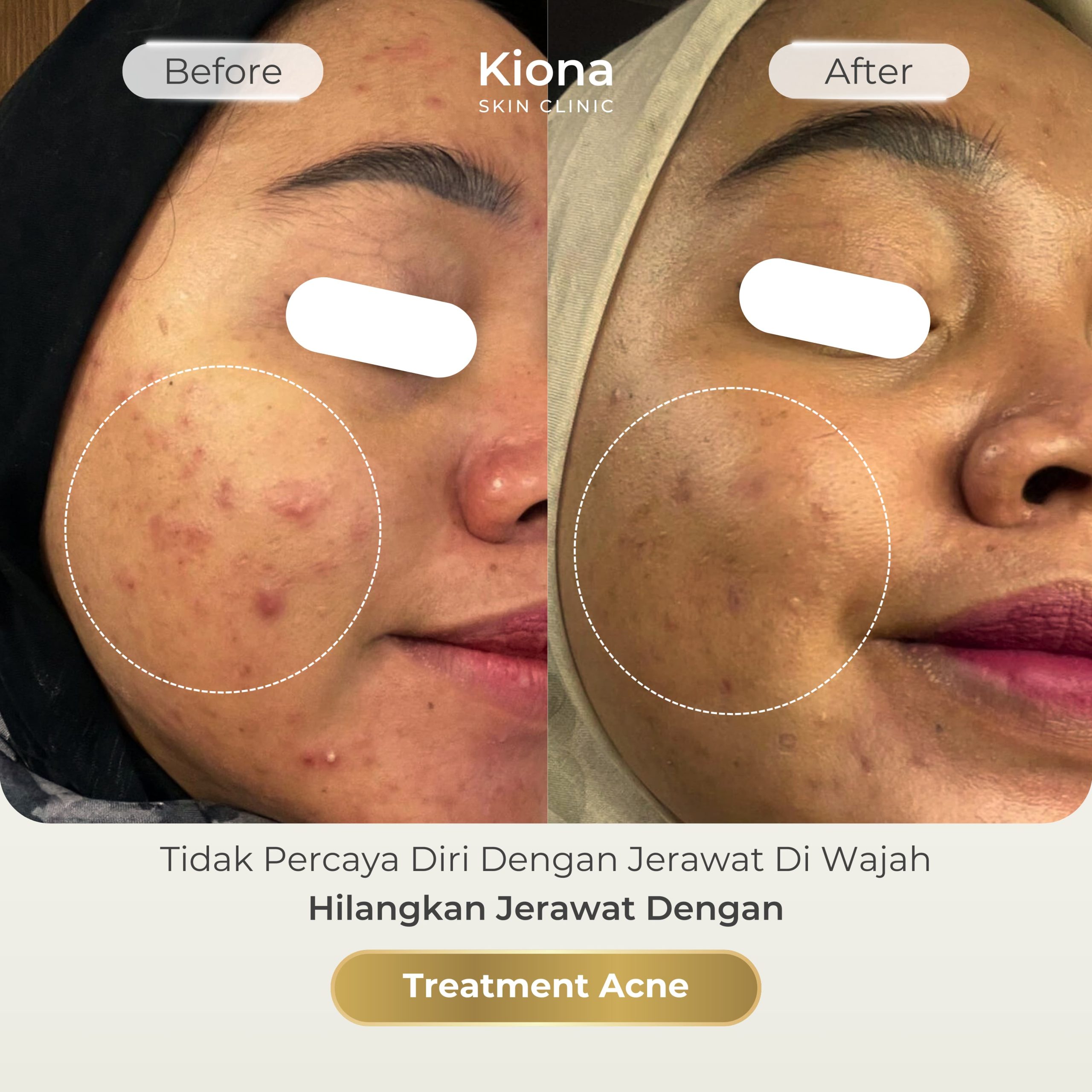 92964254-0a64-4295-a3fc-866ef1a2319b