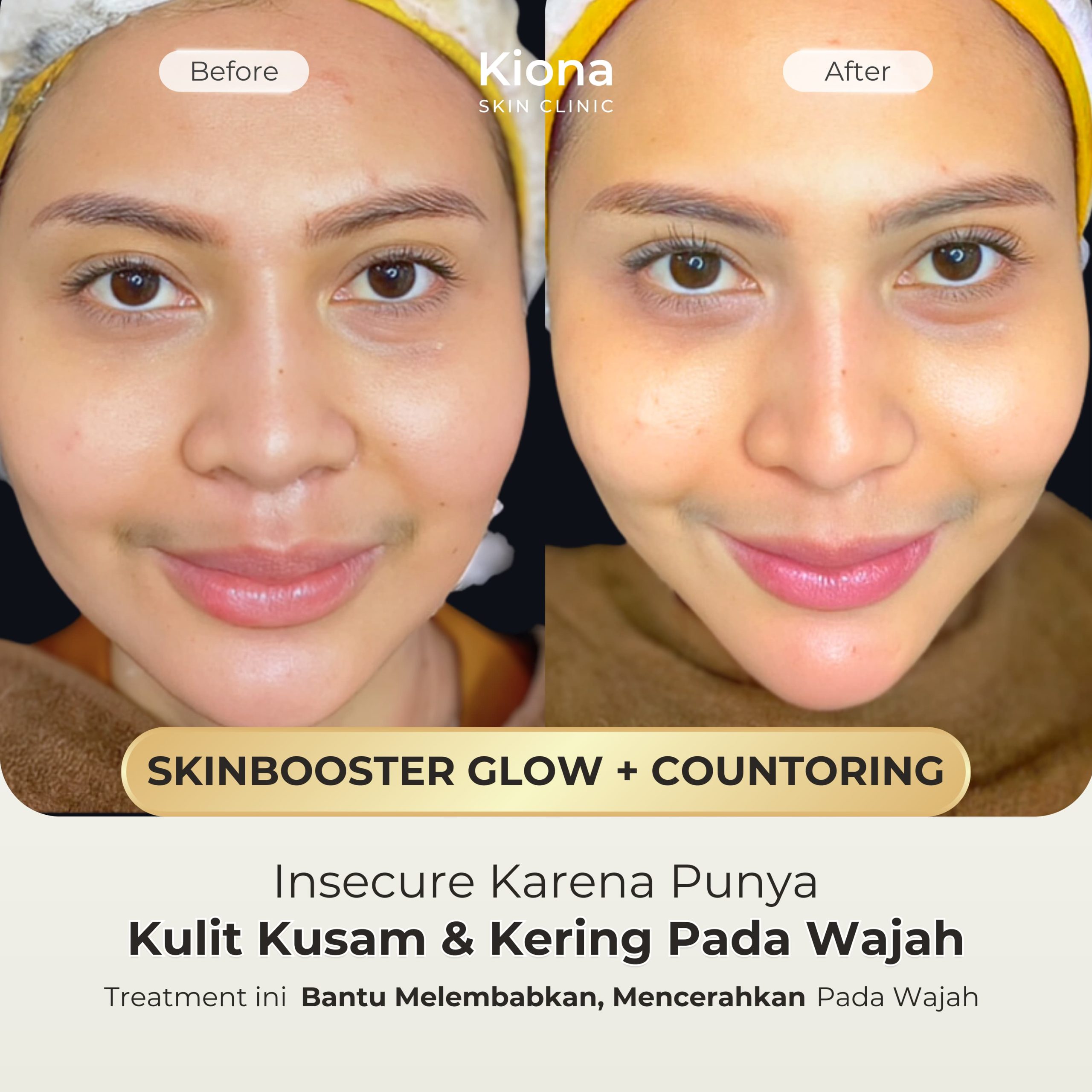 cd156f05-6e2c-4e44-a03a-a03ca9b0138f